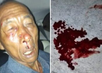 Perampok Bersenjata Api Beraksi, Sabin Warga Dusun Kamandilan Desa Jangraga Mangunjaya Pangandaran Dilarikan Ke RSU Kota Banjar