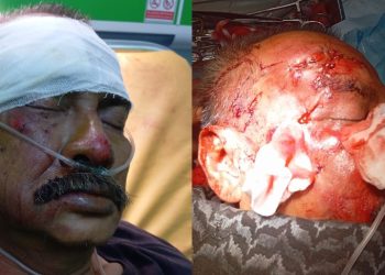 Gegara Tidak Adanya Petugas Khusus Pengamanan Proyek Jalan, H. Budi Rahmadi Tersungkur Luka Parah