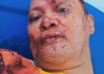 Warnning! Jalan Siliwangi Masih Rawan Begal, Asep Warga Lemah Abang Nyaris Tewas Oleh Pelaku Jatanras