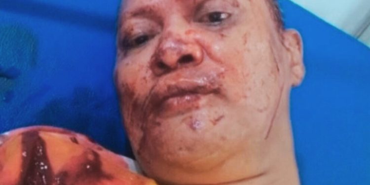 Warnning! Jalan Siliwangi Masih Rawan Begal, Asep Warga Lemah Abang Nyaris Tewas Oleh Pelaku Jatanras